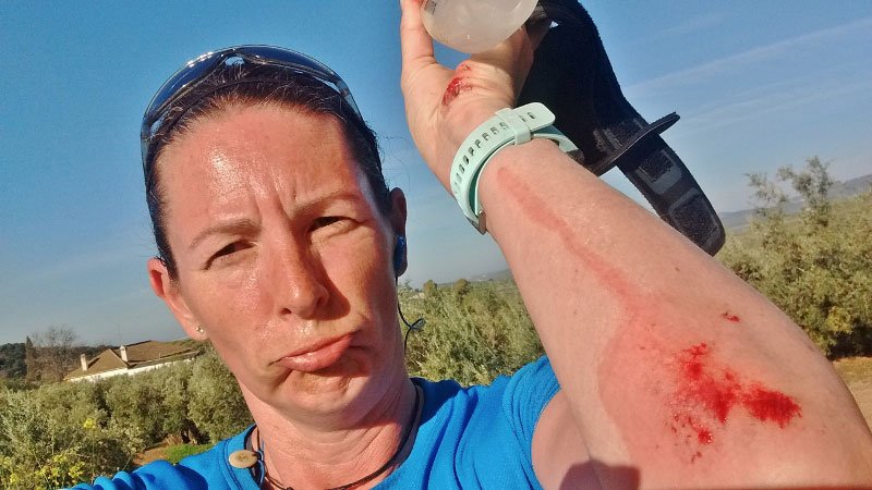 grazed elbow and hand after fall when running