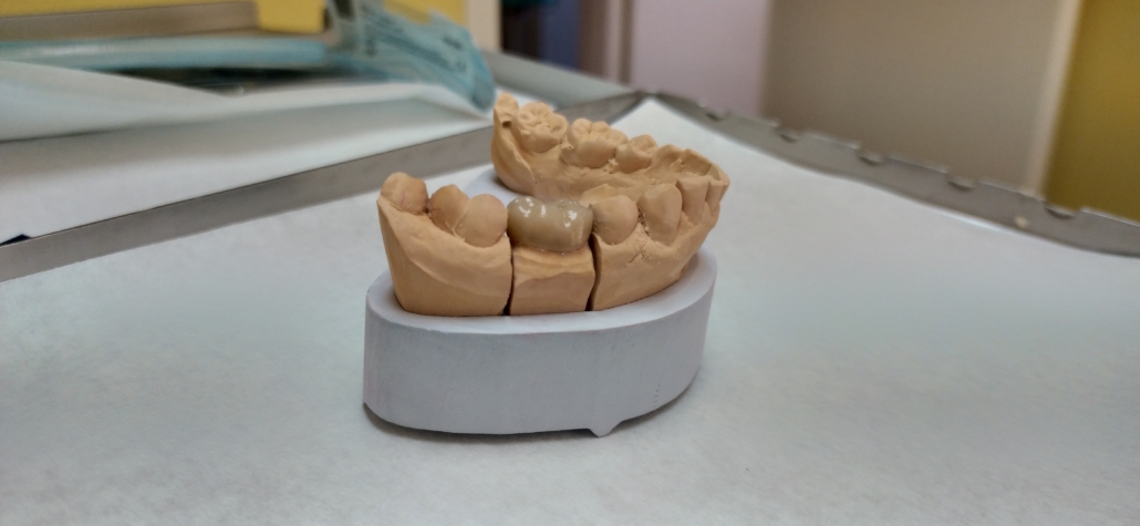 Miguel, demonstrating just how off-white the rest of my teeth are. I blame all that stout.